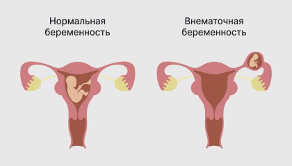 Врождённые пороки сердца (ВПС) — что это, причины, симптомы, классификация