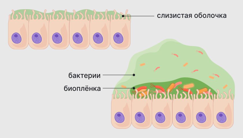 Биопленка