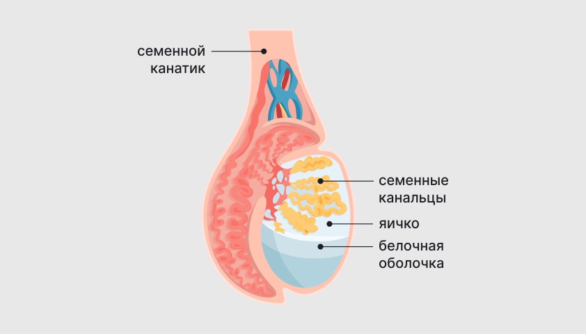 Рак яичка — симптомы, признаки у мужчин