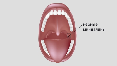 Нёбные миндалины