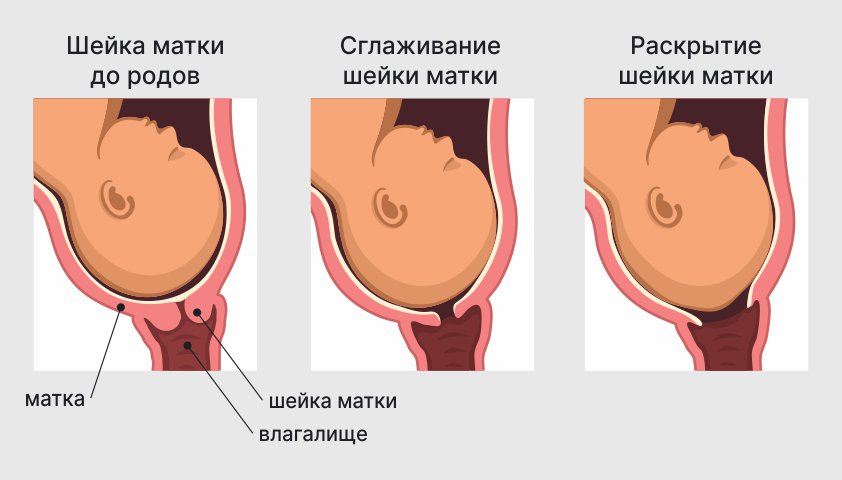 Шейка матки — как выглядит у женщины, где находится, нормы длины