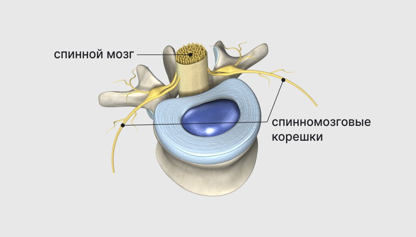 Дорсопатия - шейного, грудного и поясничного отдела, что это, причины