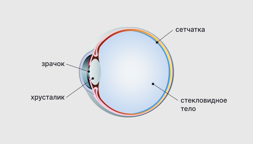 Деструкция стекловидного тела - что это, причины, симптомы