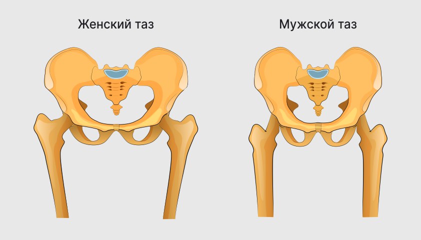 Осложнения артроза тазобедренного сустава